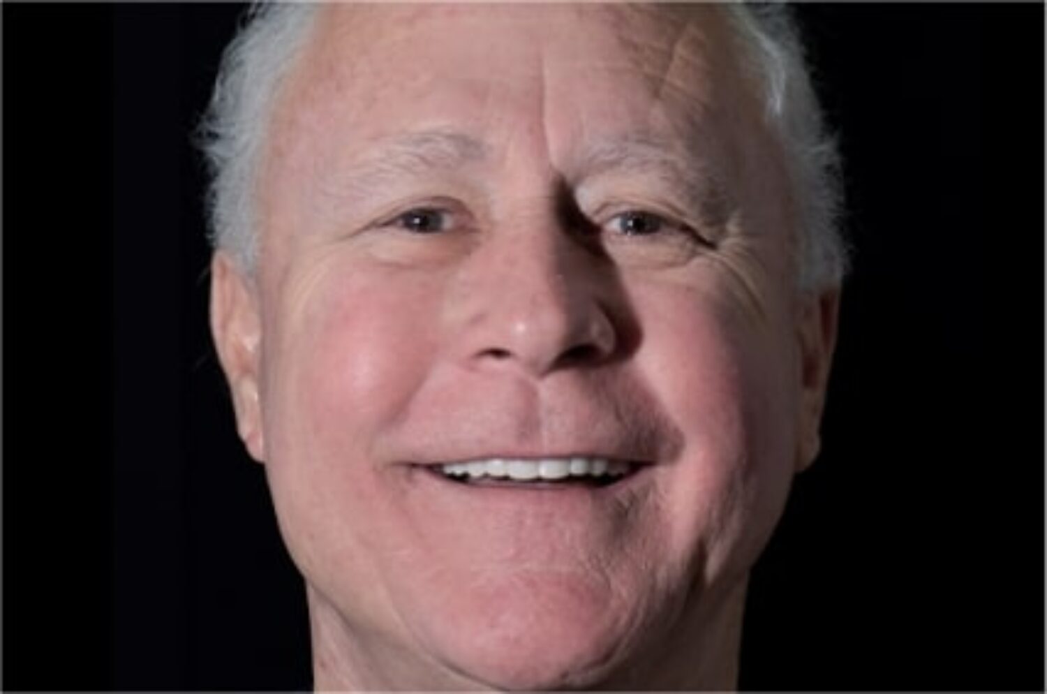 x dentistry patient implants after 01