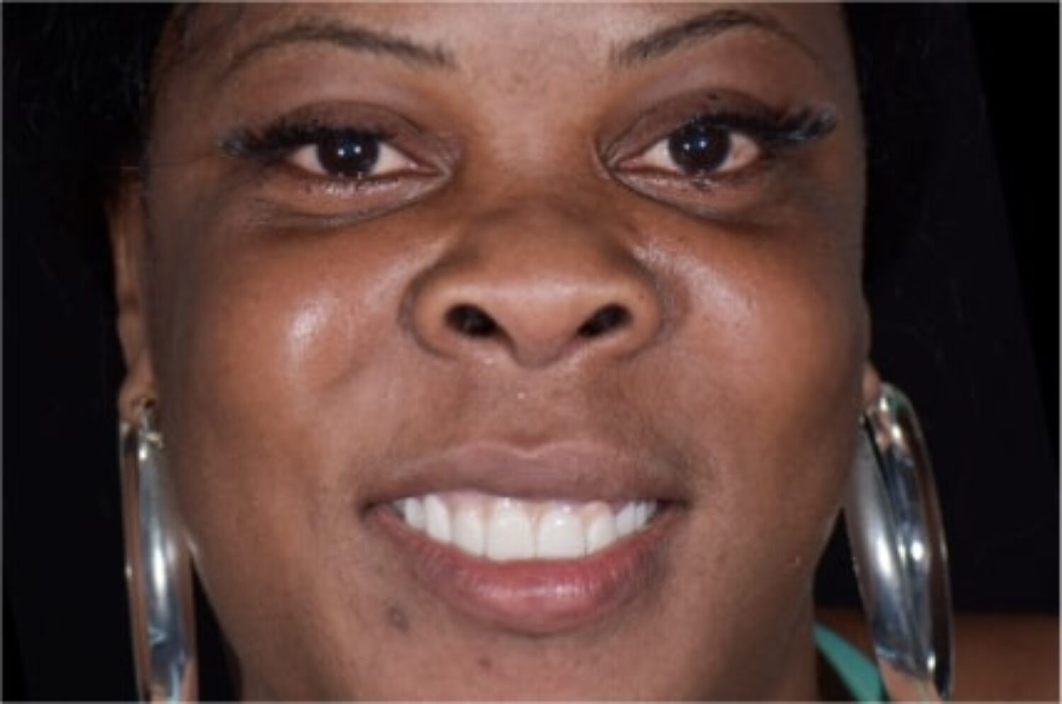 x dentistry prices cleaning 01