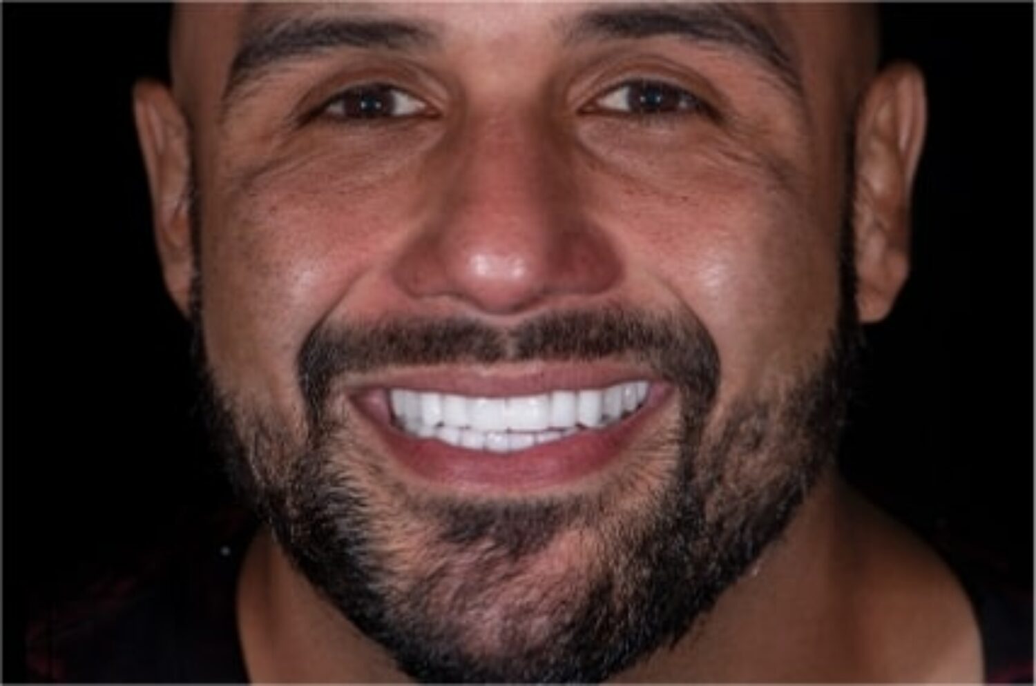 x dentistry prices cleaning 02