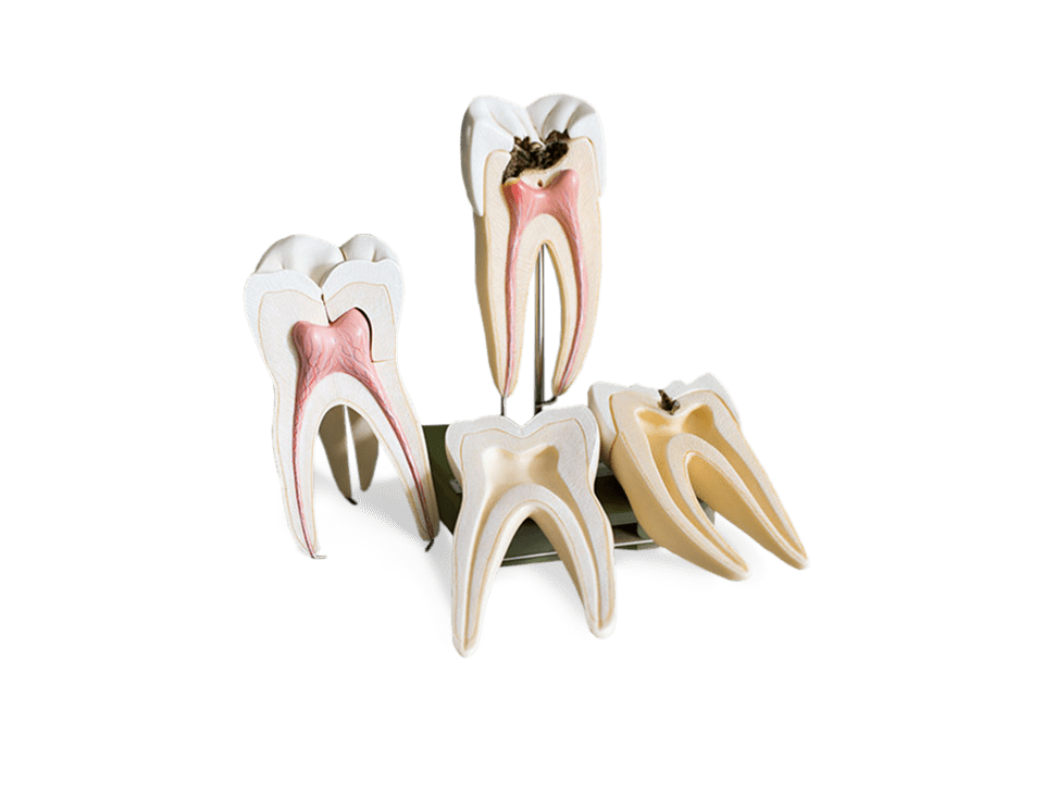 Root Canals Tijuana Certified Endodontist Prices & Free Quote [2023]