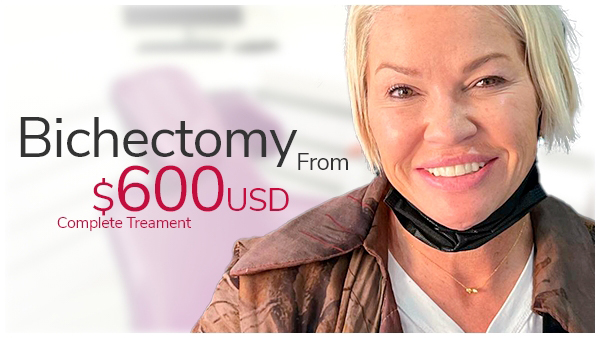 bichectomy price banner