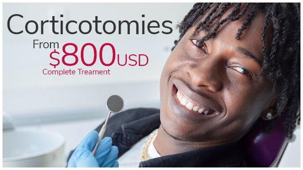 corticotomies price banner