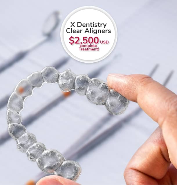 Tijuana Dental Pricelist 2022 - Implant & Cosmetic Dentist