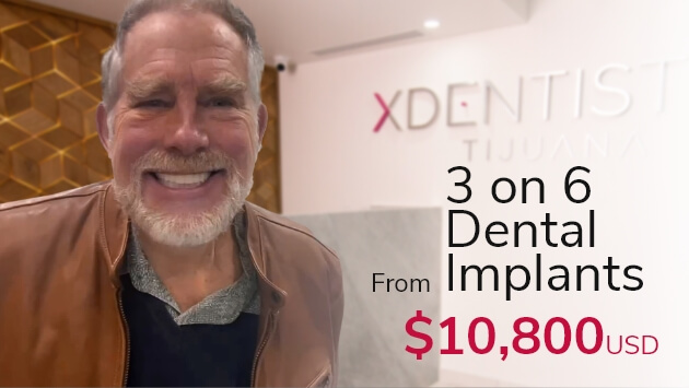 Best Dentist Tijuana| XDentistry Dental Tourism| Implant & Cosmetic