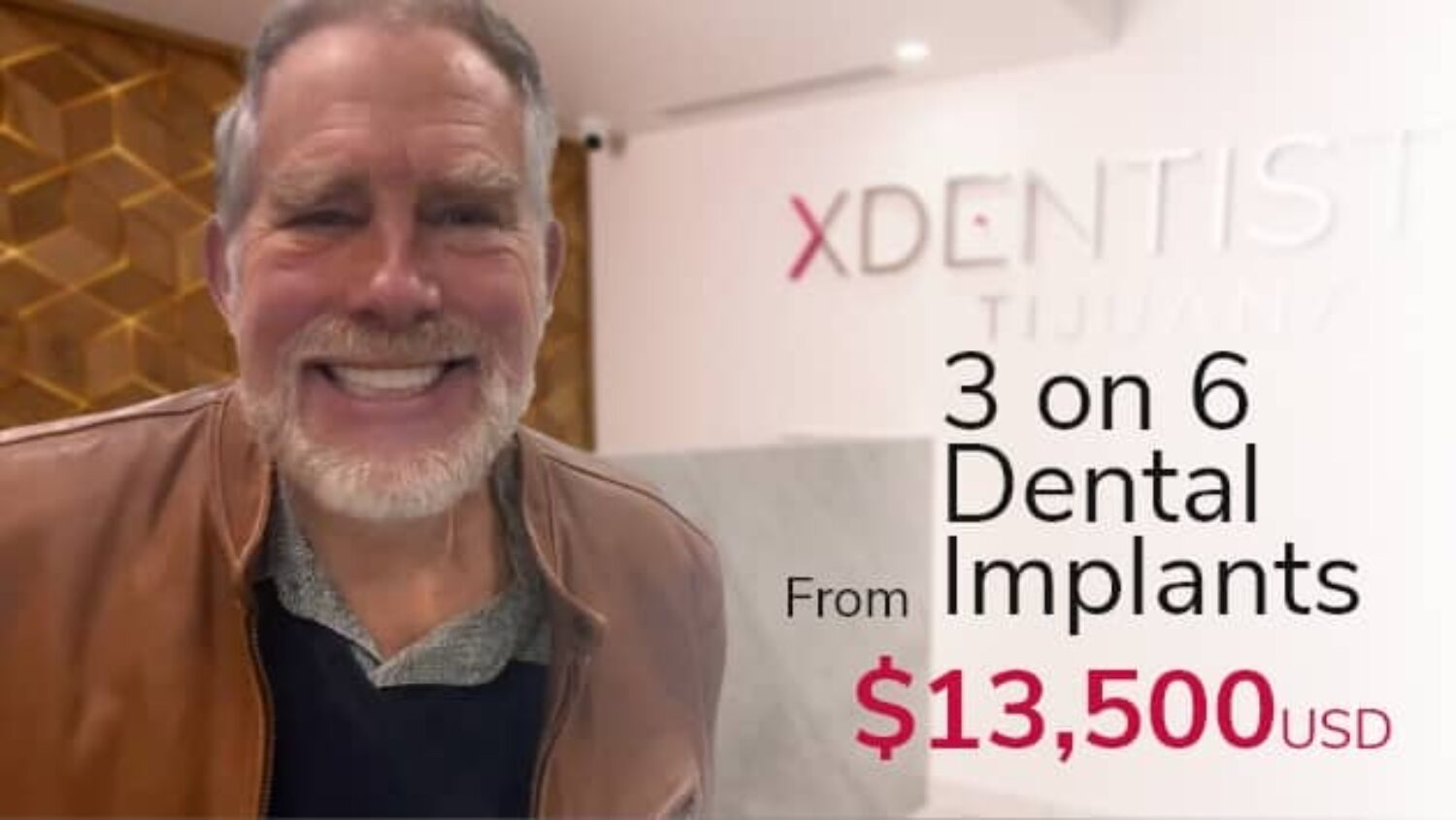 3 on 6 dental implants