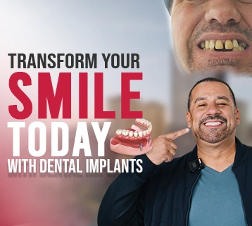 Best Dental Implant Brands