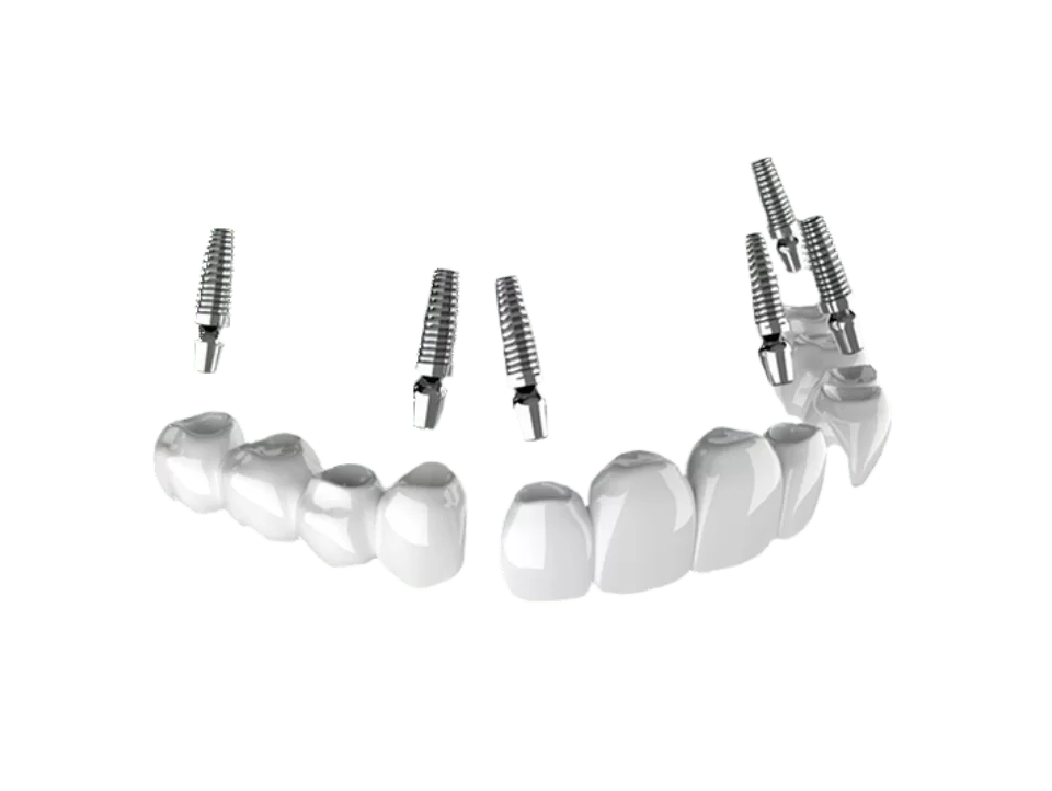 x dentistry 3 on 6 model