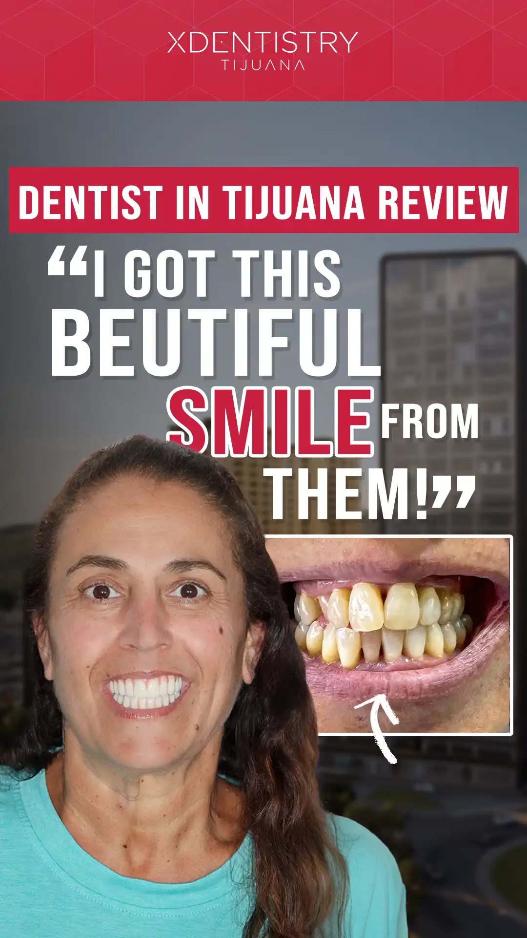 dental review video