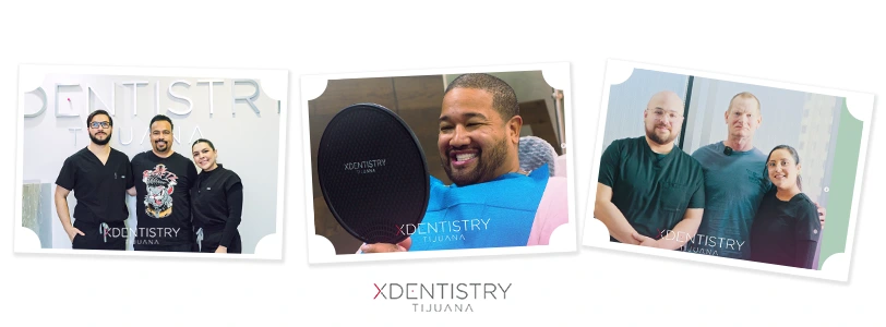 dream smile just one consultation away all on x dental implants mexico