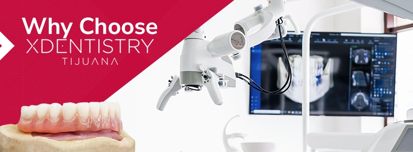 why choose x dentistry tijuana all on 6 treatment