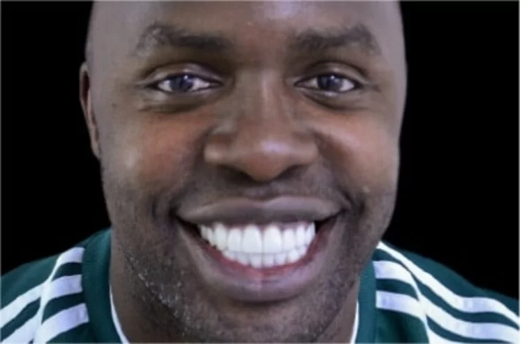 x dentistry crowns after 01