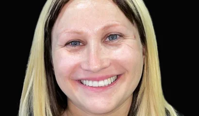 x dentistry patient implants after 01