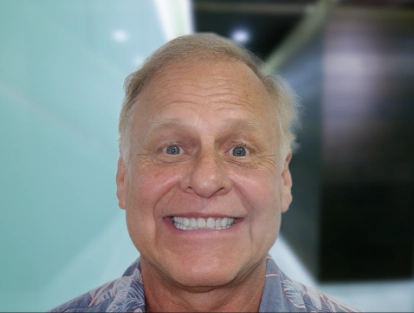 x dentistry dental implants all on 4
