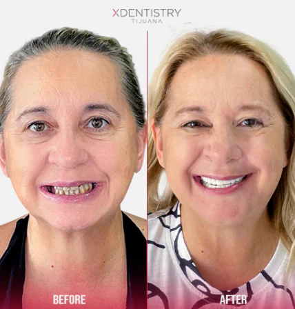 newcity medical plaza tijuana