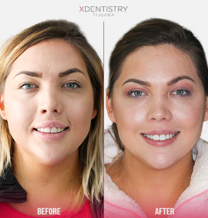 newcity medical tijuana plaza