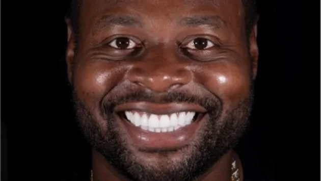 x dentistry cosmetic dentistry after patient 01