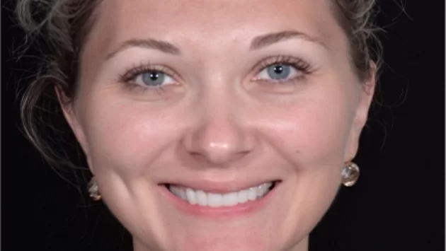 x dentistry cosmetic dentistry after patient 03