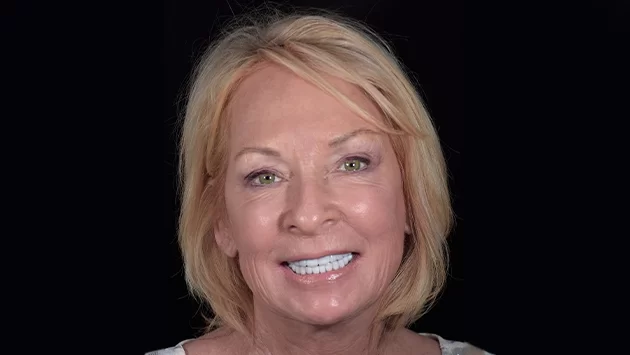 x dentistry restorative dentistry after patient 02