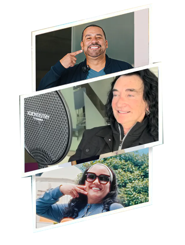 smile design process veneers