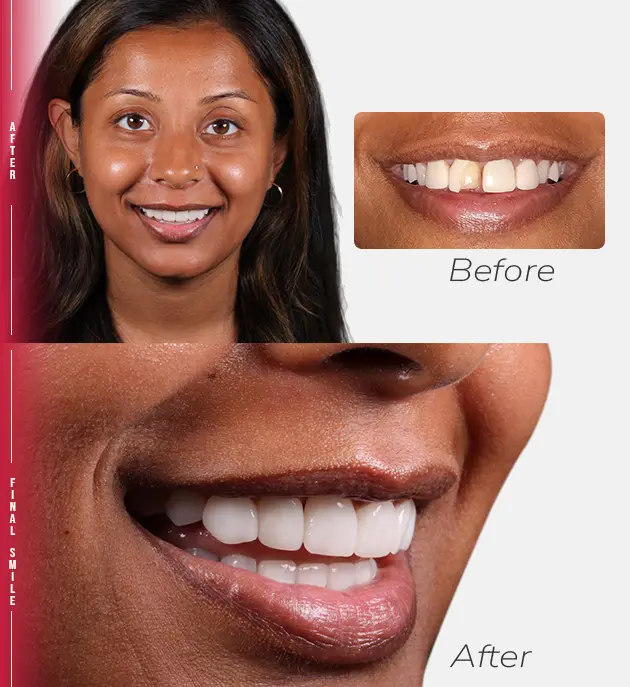 dental patient happy tijuana