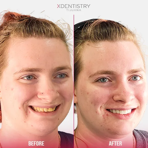 all on 4 testimonial