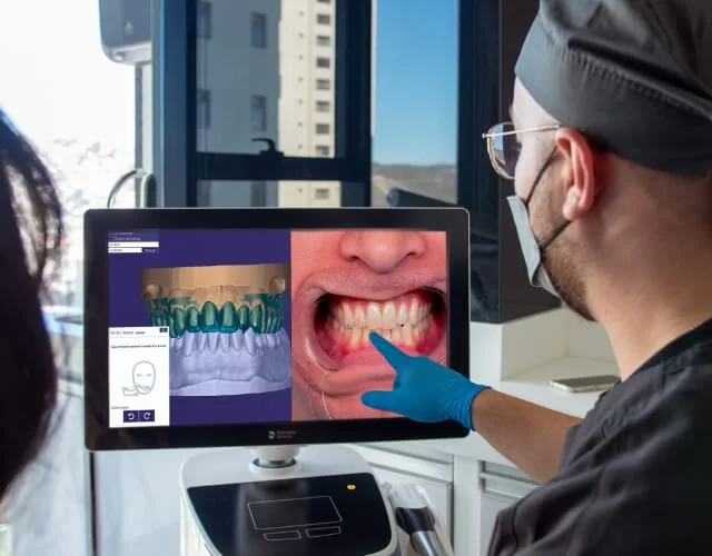 Smile Design Software