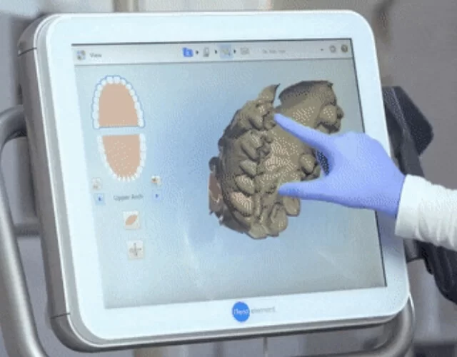 itero technology