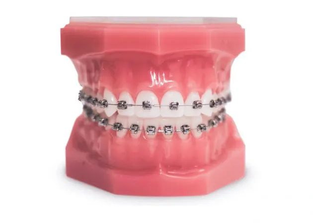 Metal Braces Tijuana