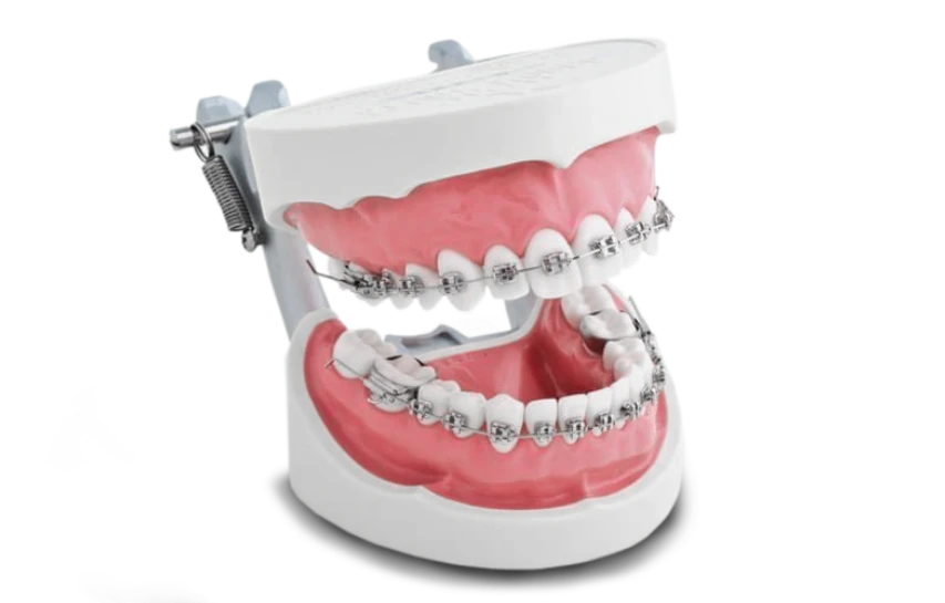 x dentistry invisalign protector