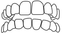 structure 01 Gapped Teeth