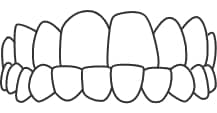 structure 02 Underbite
