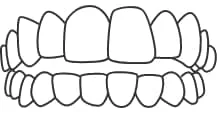 structure 03 Open Bite