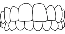 structure 04 Overbite