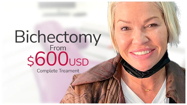 bichectomy price banner