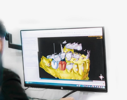 state technology root canal tijuana