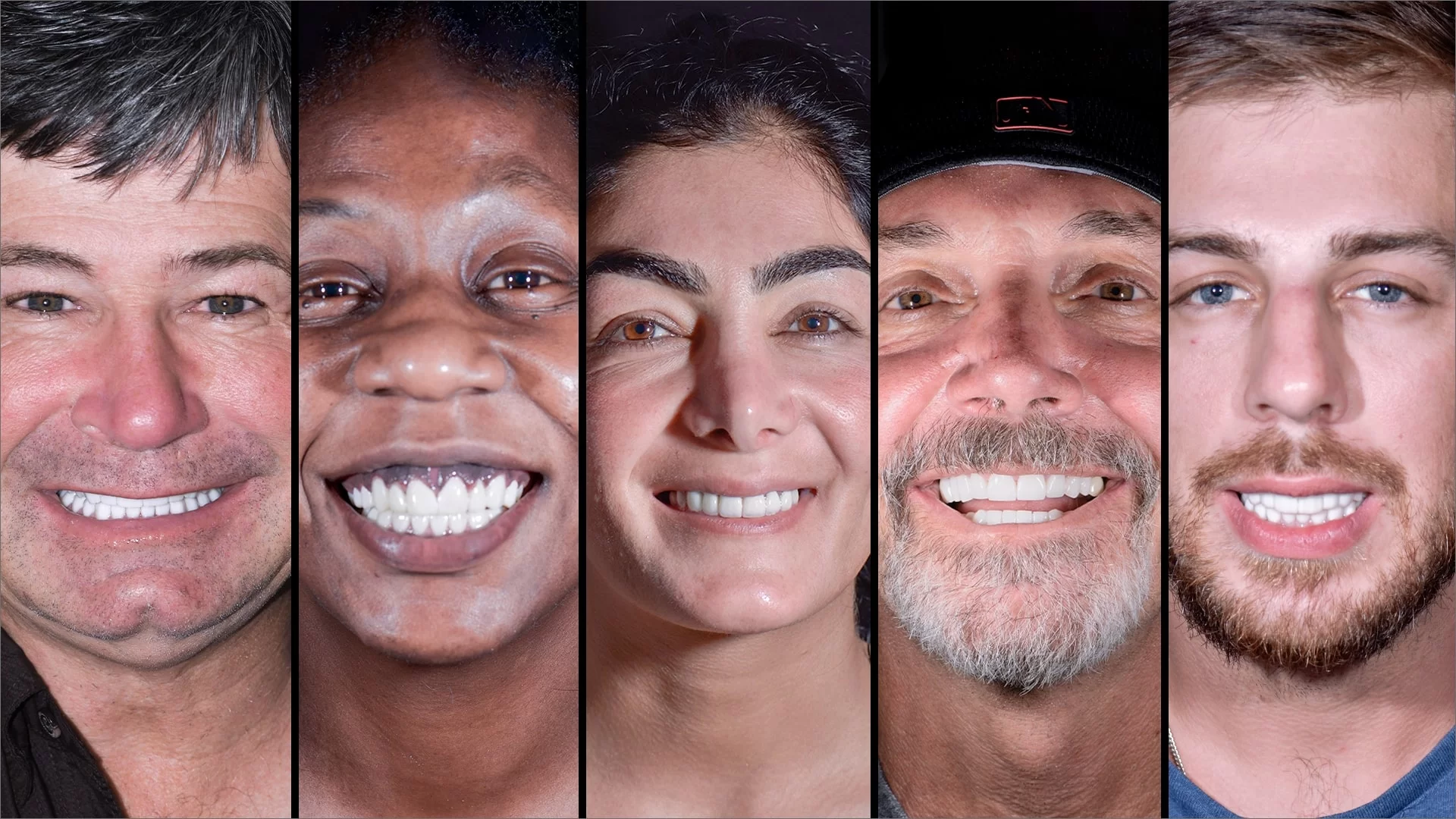 x dentistry smile makeover