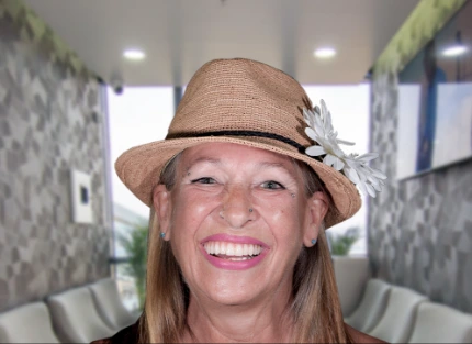 x dentistry smile makeover veneers patient