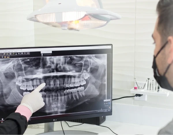 x dentistry Dental Implants for Snap on Dentures