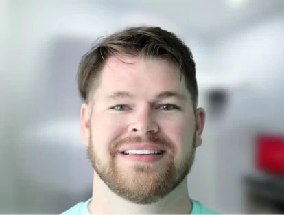 x dentistry teeth whitening veneers patient