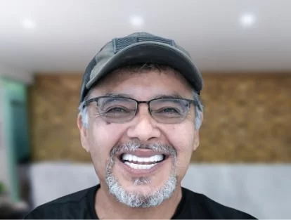 x dentistry teeth whitening crowns patient