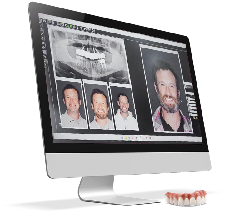 tijuana dentist evaluation