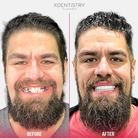 all on 4 testimonial