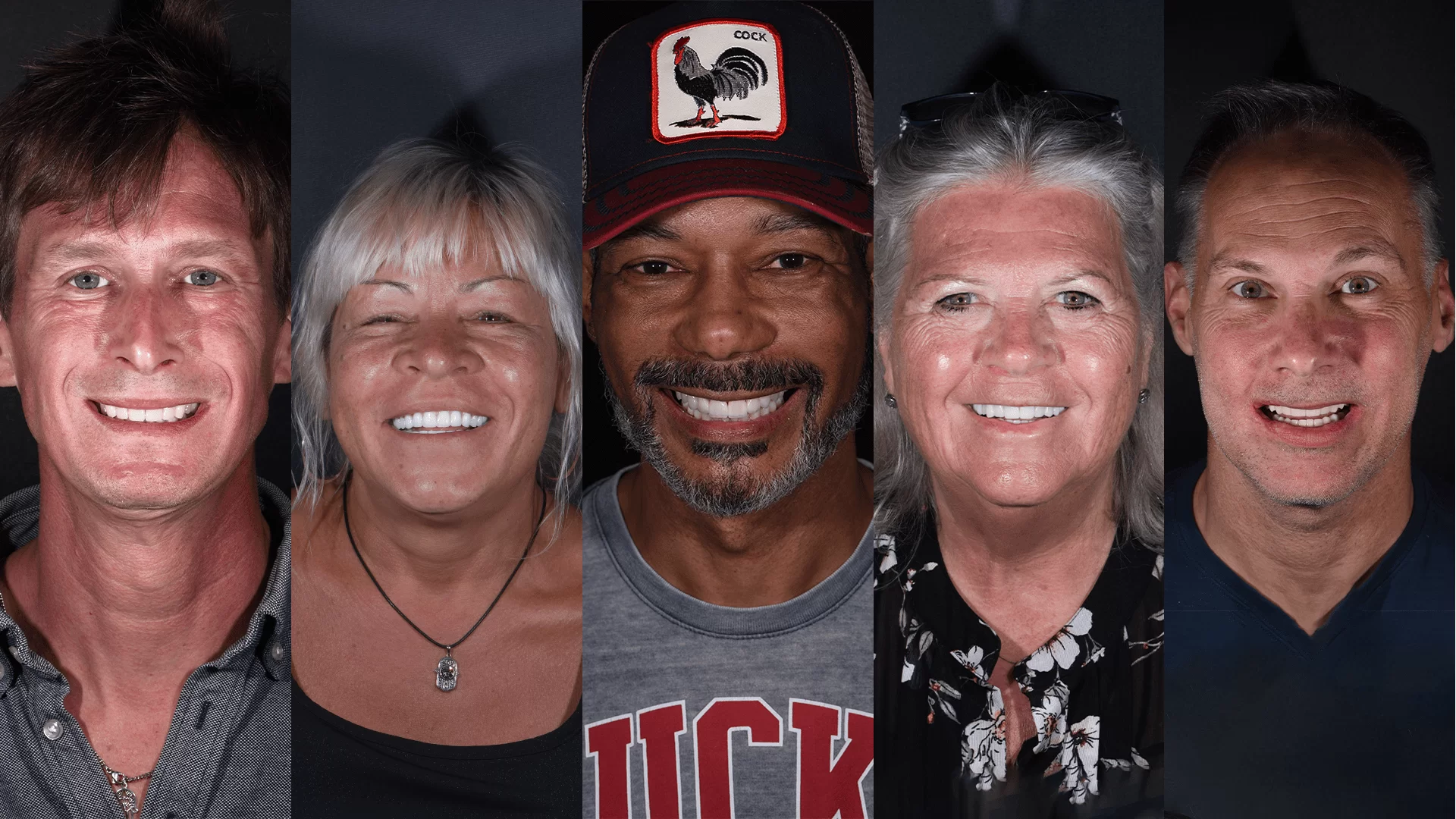 x dentistry all on 4